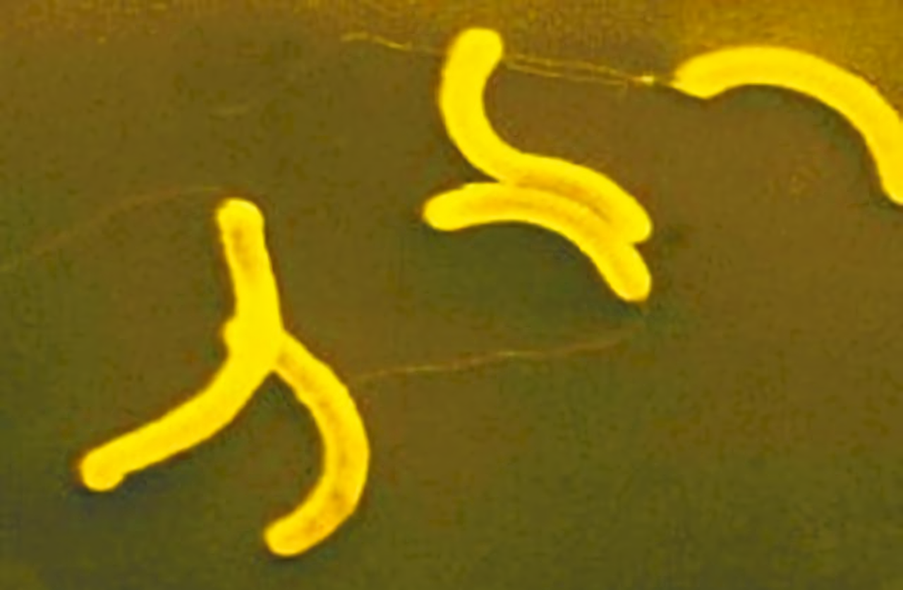 Ang unang domestic case ng cholera sa Taiwan ngayong taon, kaya binabalaan ng CDC na iwasan ang hilaw na seafood