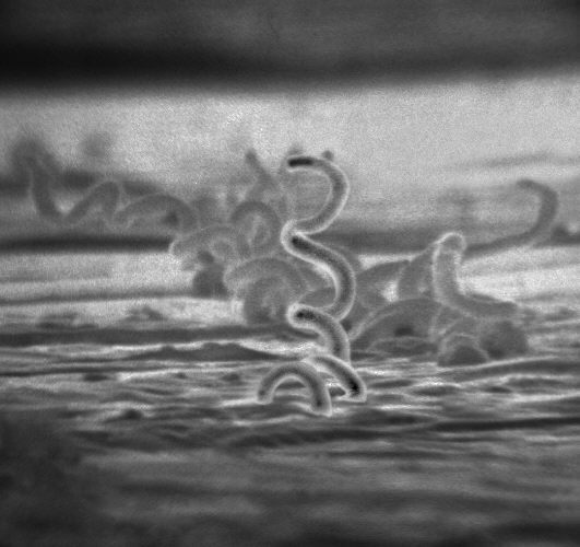 Ang biglang pagtaas ng syphilis sa Tokyo ay maaaring magtakda ng bagong rekord sa loob ng tatlong taon